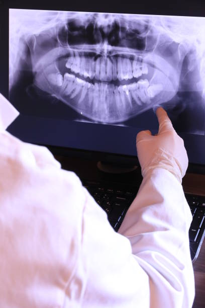 Best Emergency Wisdom Tooth Extraction in Shoreacres, TX