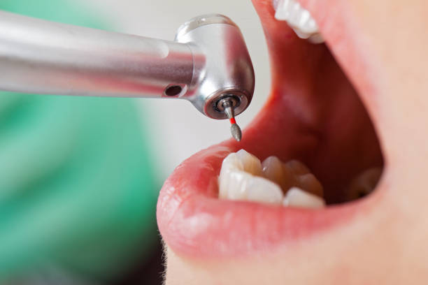 Best Emergency Denture Repair in Shoreacres, TX